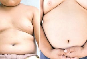 Children living with obesity lament